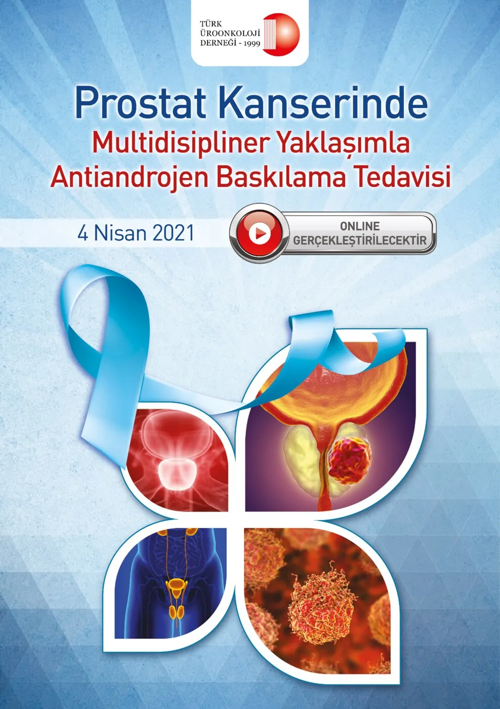 Prostat Kanserinde Multidisipliner Yaklaşımla Antiandrojen Baskılama Tedavisi